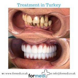 clinic Turkey dental