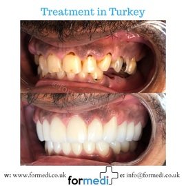 clinic Turkey dental