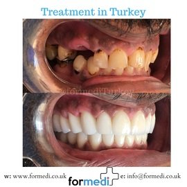 clinic Turkey dental