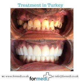 clinic Turkey dental