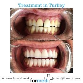 clinic Turkey dental