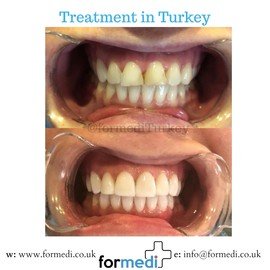 clinic Turkey dental