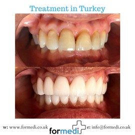 clinic Turkey dental