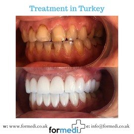 clinic Turkey dental