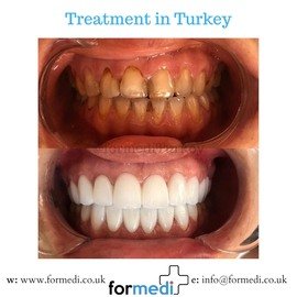 clinic Turkey dental