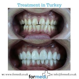 clinic Turkey dental
