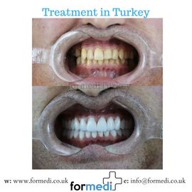 clinic Turkey dental