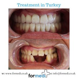 clinic Turkey dental