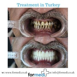 clinic Turkey dental