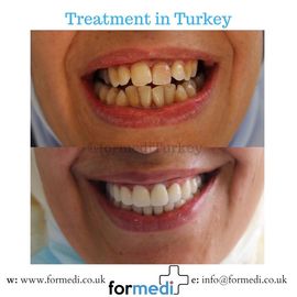 clinic Turkey dental