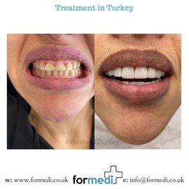 clinic Turkey dental