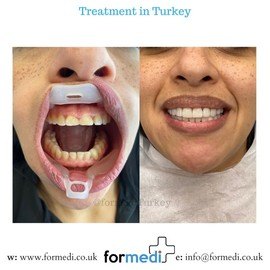 clinic Turkey dental