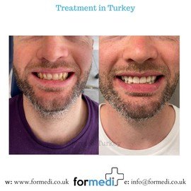 clinic Turkey dental