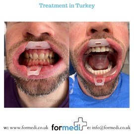 clinic Turkey dental