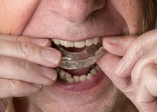 Diş Sıkma Tedavisi