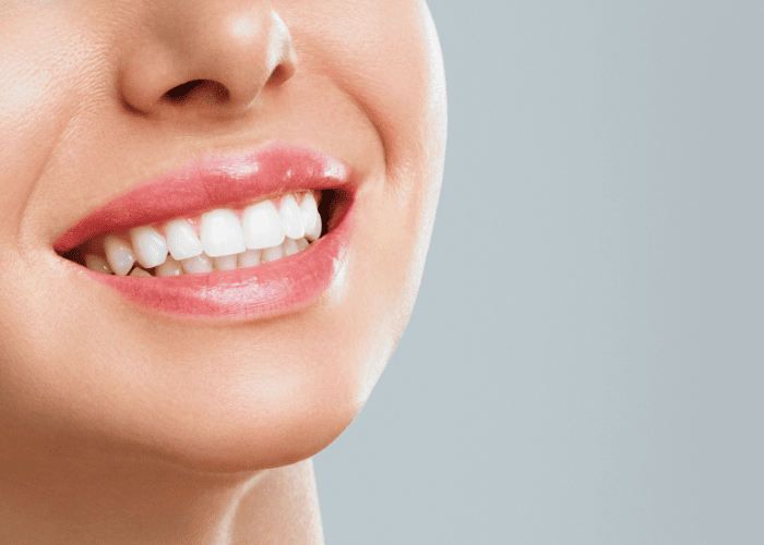 Doğal Görünümlü Diş Kaplamaları