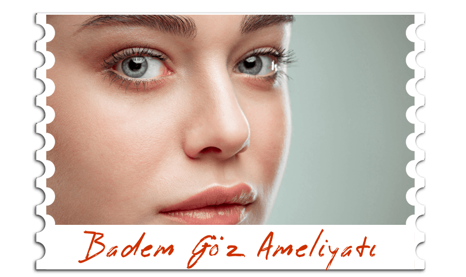 Badem Göz Ameliyatı