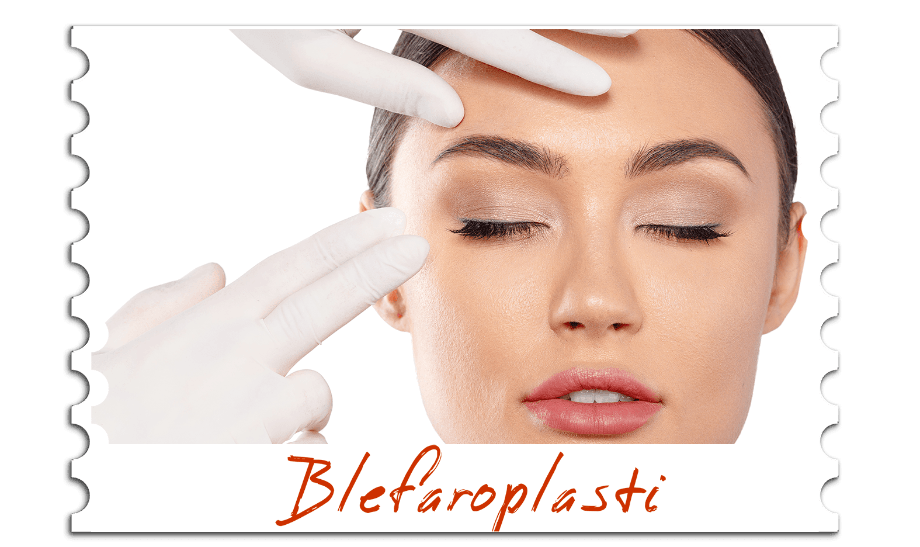 BLEFAROPLASTİ