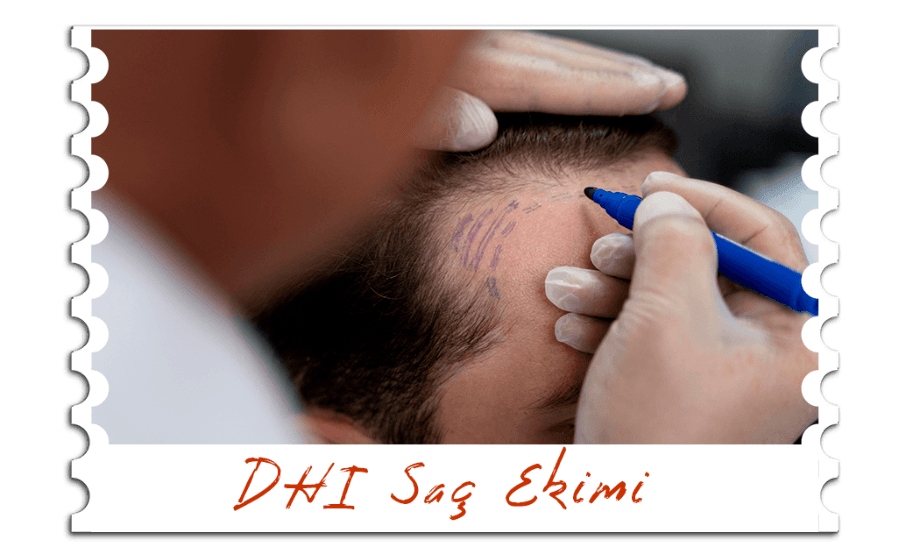 DHI Saç Ekimi