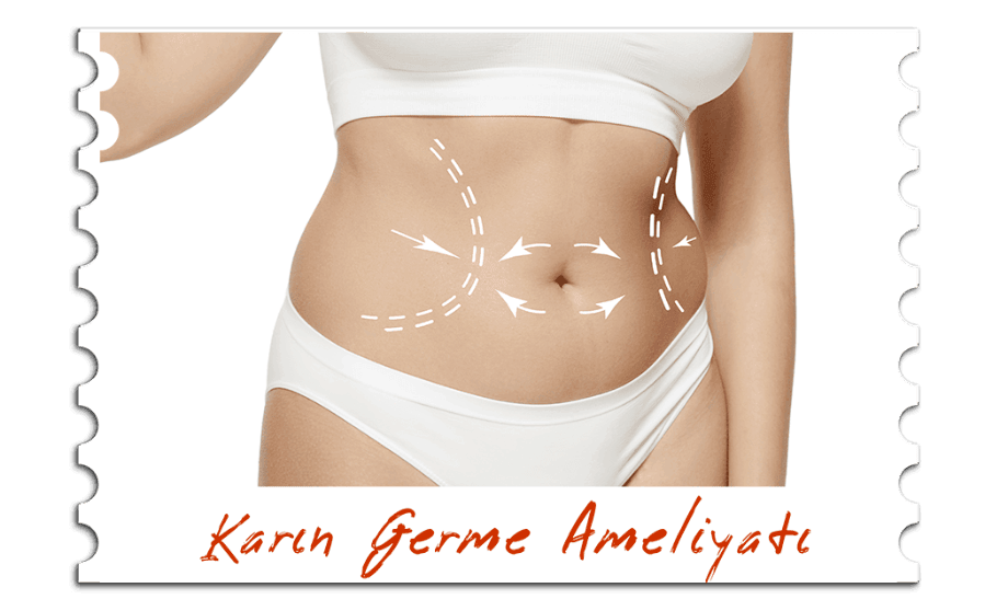 Karın Germe Ameliyatı