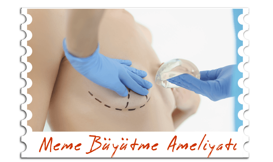 Meme Büyütme Ameliyatı