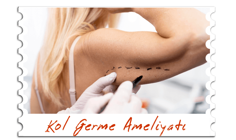 Kol Germe ameliyatı