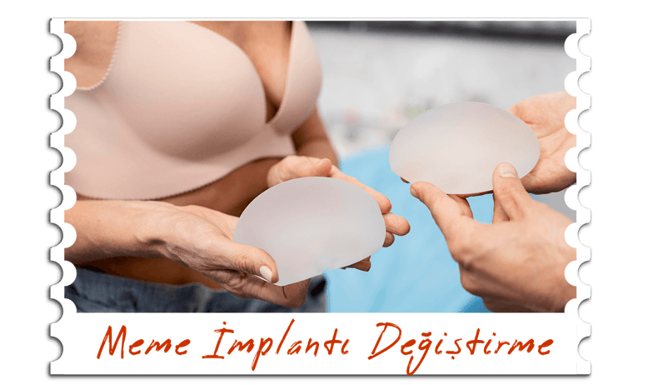 Meme İmplantı Değiştime