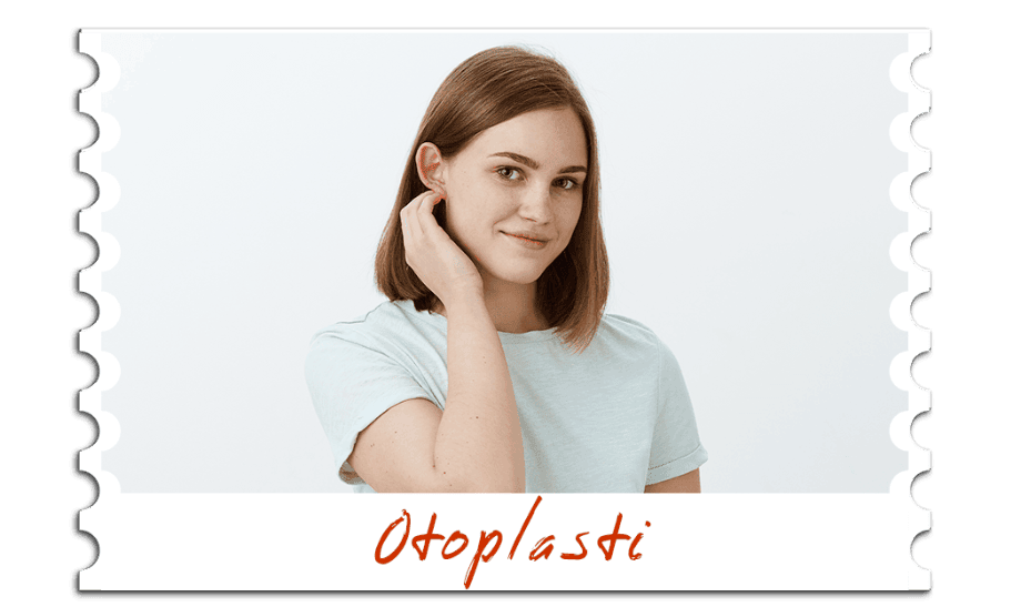 Otoplasti