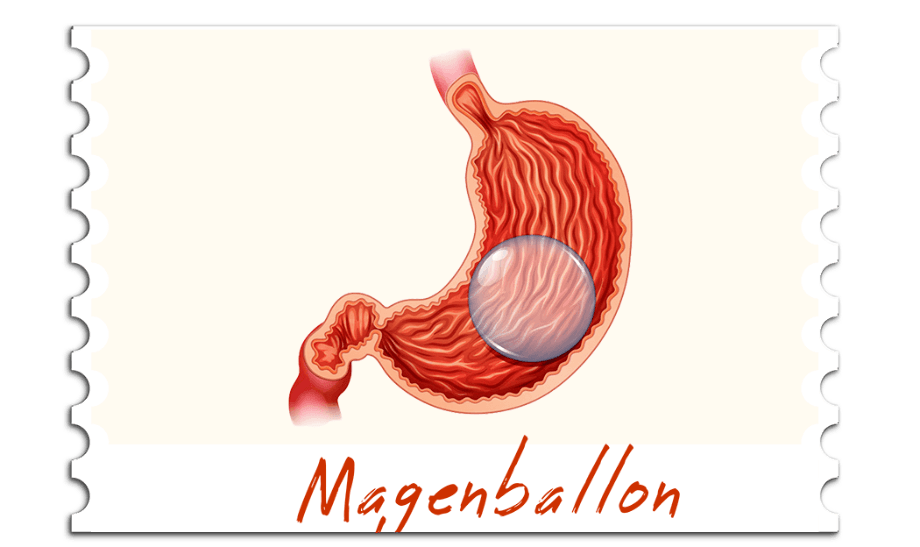 Magenballon