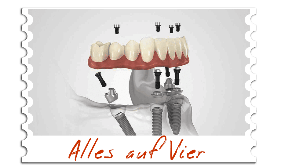 Alles auf Vier