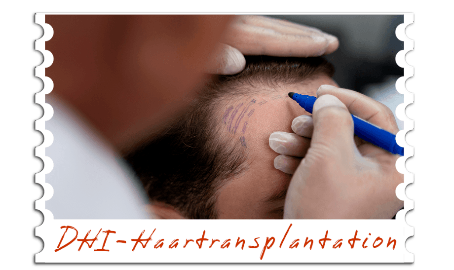DHI-Haartransplantation