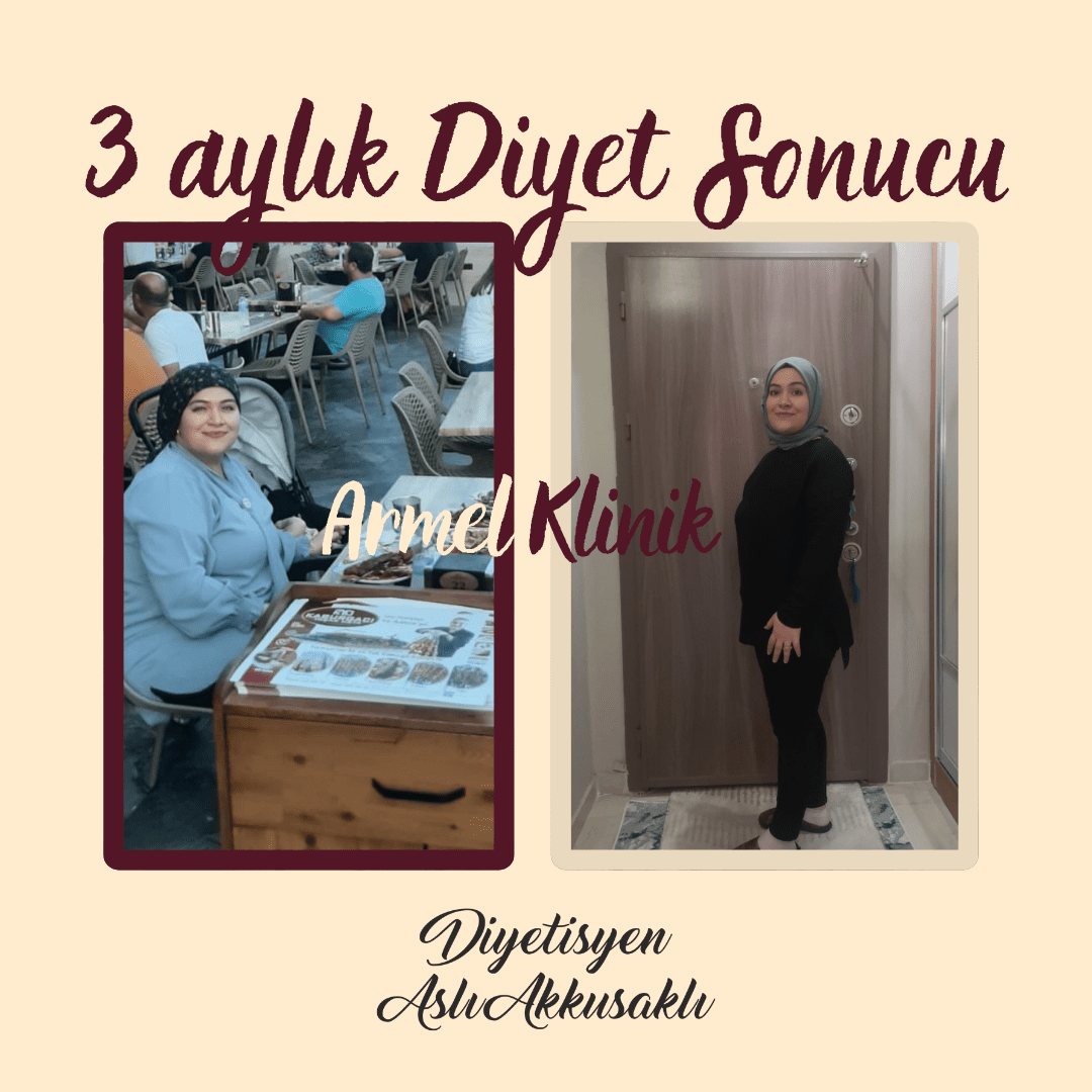 3 AYLIK DİYET SONUCU -25 KG