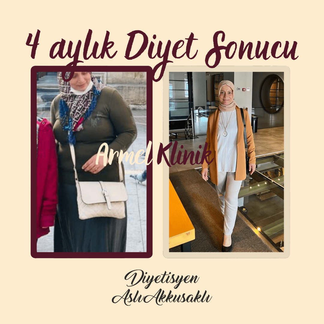 4 AYLIK DİYET SONUCU -40 KG
