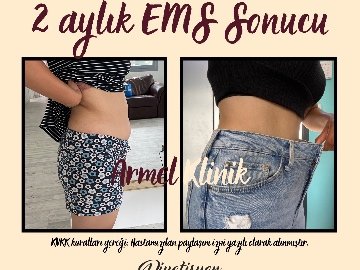 2 AYLIK EMS SONUCU -6 KG