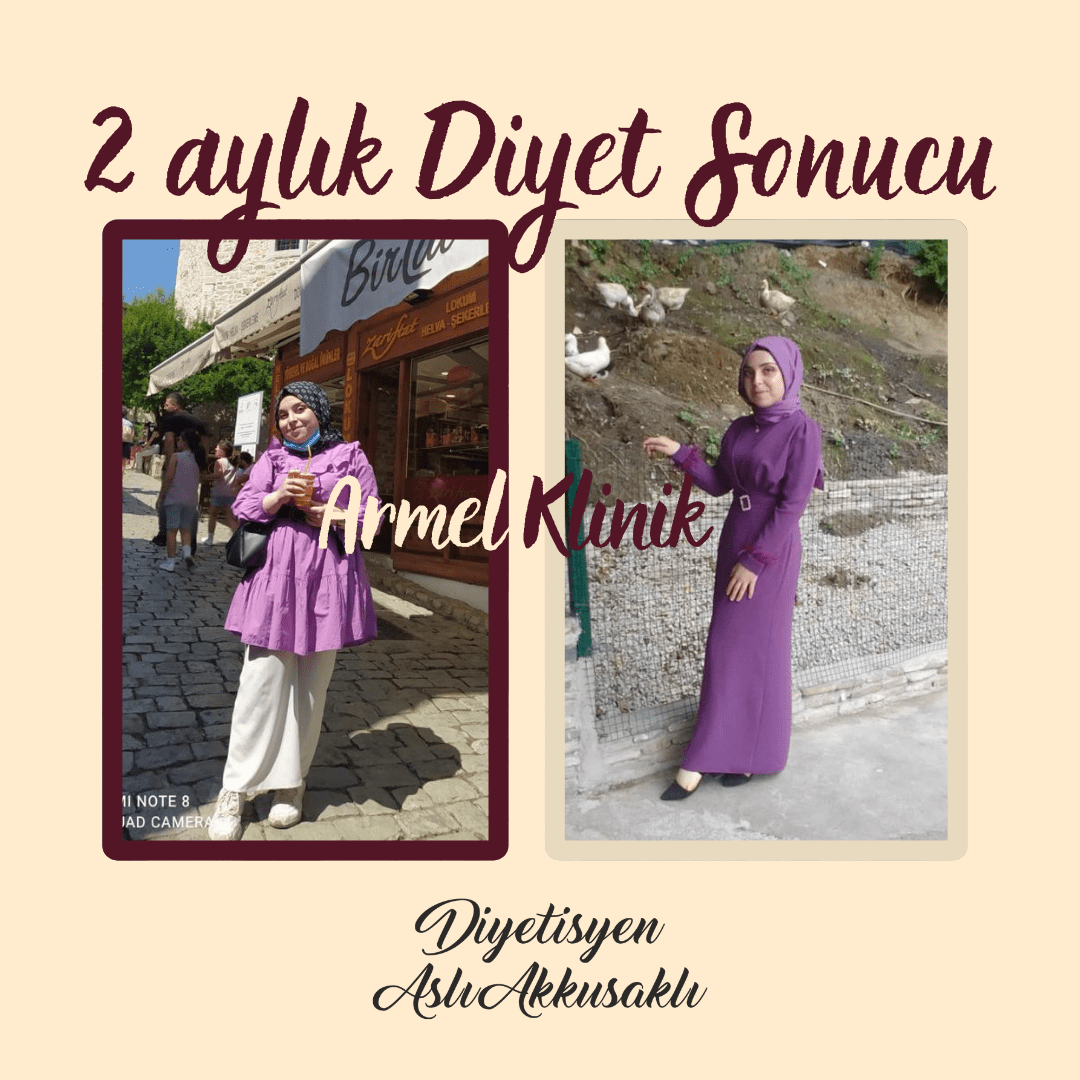 2 AYLIK DİYET SONUCU -20 KG