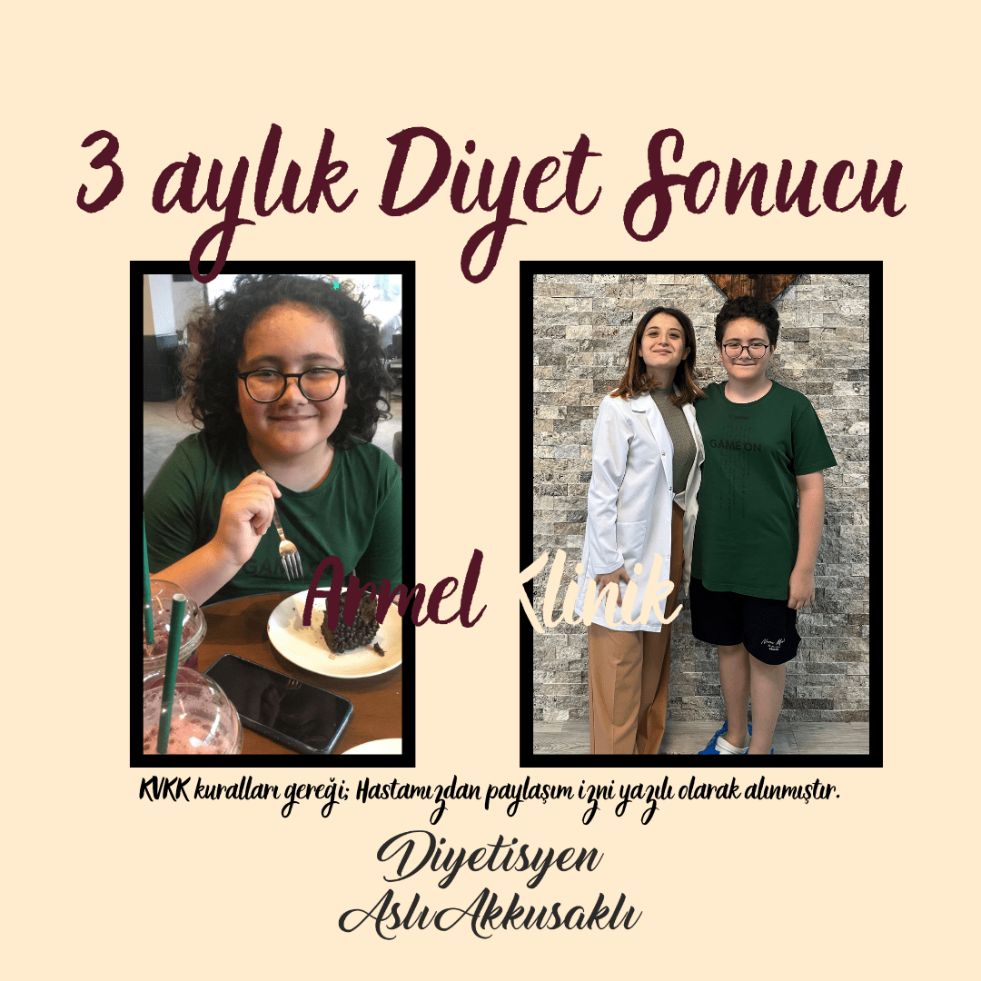 3 AYLIK DİYET SONUCU -9 KG