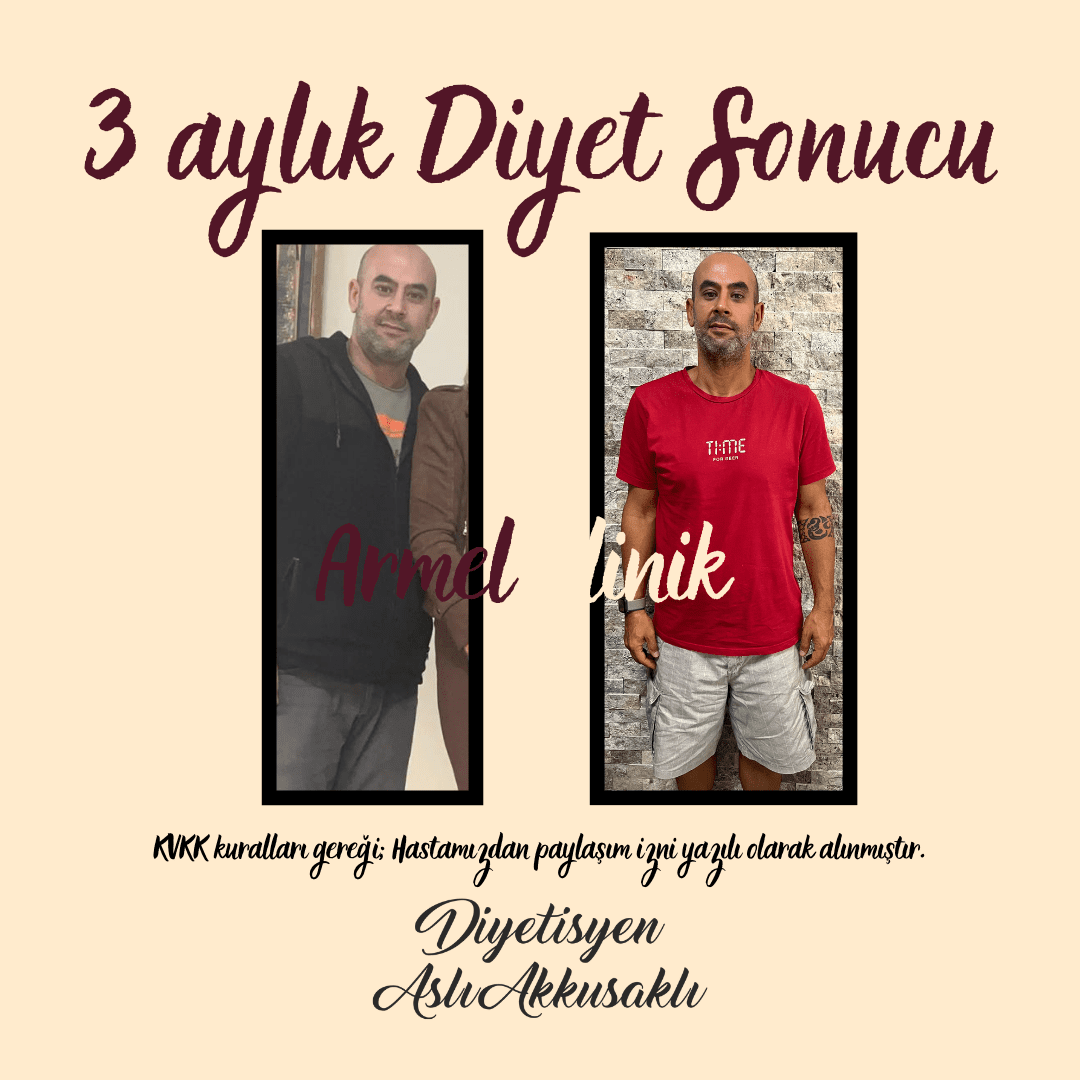 3 AYLIK DİYET SONUCU -15 KG