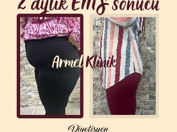 2 AYLIK EMS SONUCU -23 KG