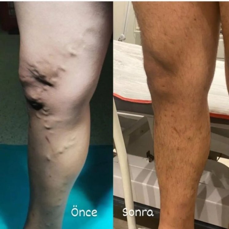 Screenshot_20230510_133709_Instagram