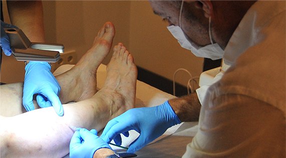 Köpük-Skleroterapi