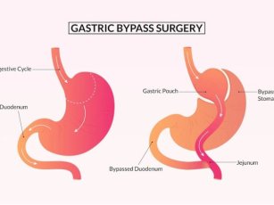 What is Lorem Ipsum?2
