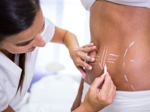 What is Lorem Ipsum?3