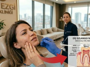 Diş Sızlaması Neden Olur? Dolgulu Diş Neden Sızlar?