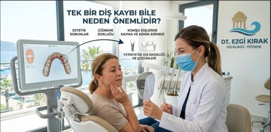 Tek Bir Diş Kaybı Bile Neden Önemlidir? Fethiye’de Diş Eksikliği ve Çözümleri.