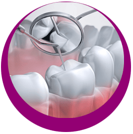 INLAYS-&-ZAHNFÜLLUNGEN