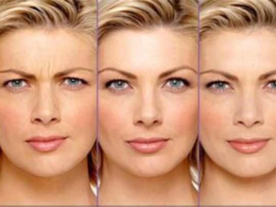 Botoks uygulamasının yan etkisi