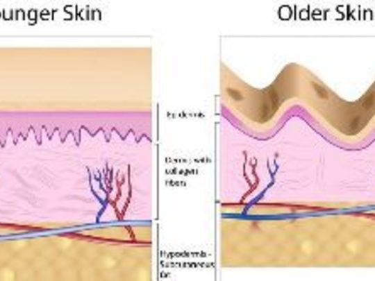 Derimize yılların etkisi...
