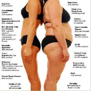 Kilo sorunu olmasaydı