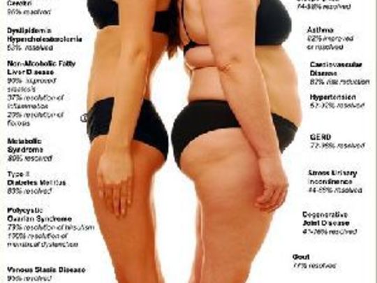 Kilo sorunu olmasaydı