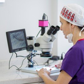 Im Jahre 2015 haben wir unsere erste Haartransplantation durchgeführt